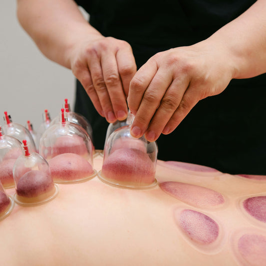 Cupping Terapi