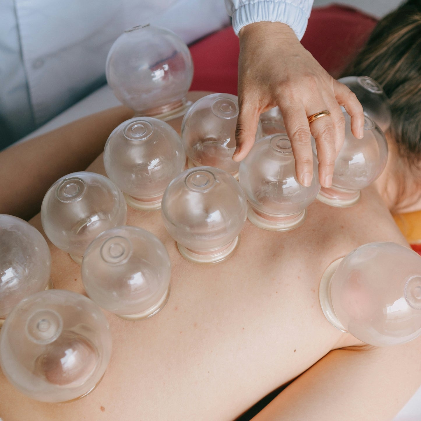 Cupping Terapi